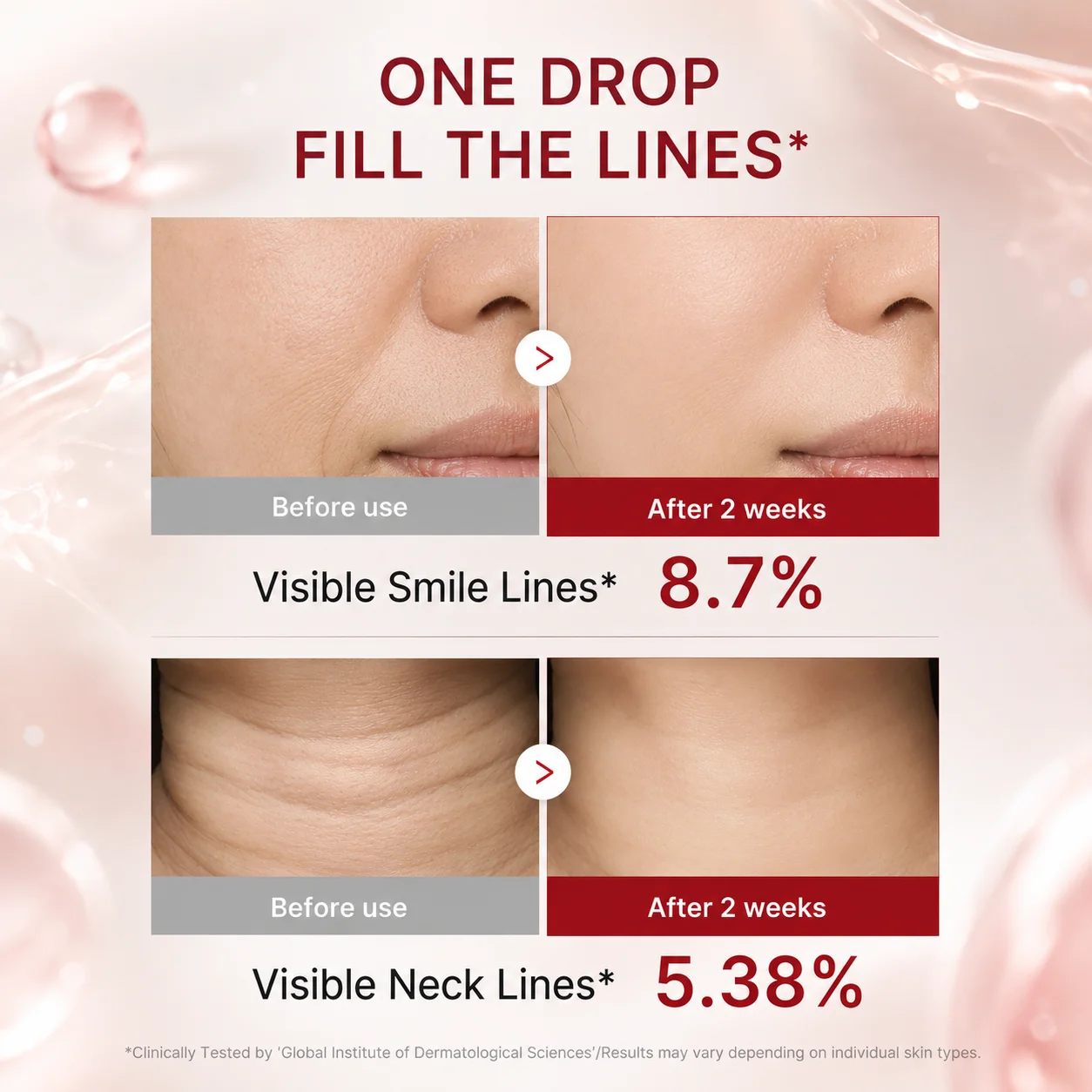Side-by-side comparison showing visible reduction in smile and neck lines before and after 2 weeks of product use.